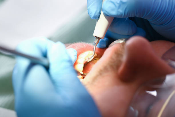 Best Emergency Treatment for Dental Infections or Abscesses in Amesti, CA