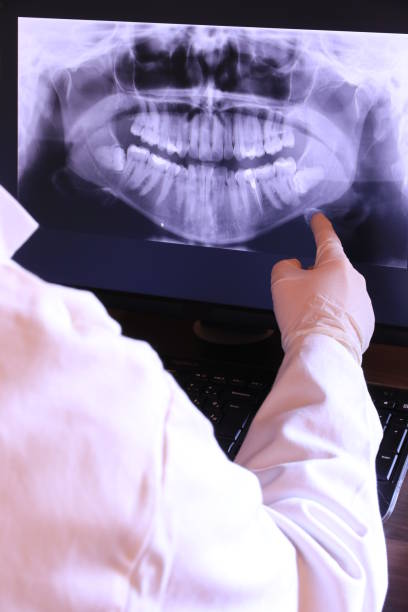 Best Emergency Dental Care for Broken or Chipped Teeth in Amesti, CA
