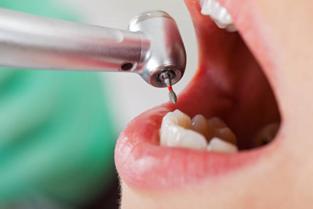 Best Same-Day Emergency Dental Services in Amesti, CA